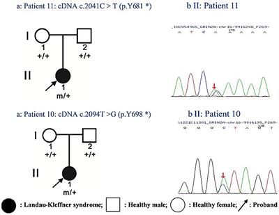 Clinical Forms and GRIN2A Genotype of Severe End of Epileptic-Aphasia Spectrum Disorder
